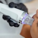 Making the Right Choice Four Key Factors When Buying Medical Lasers